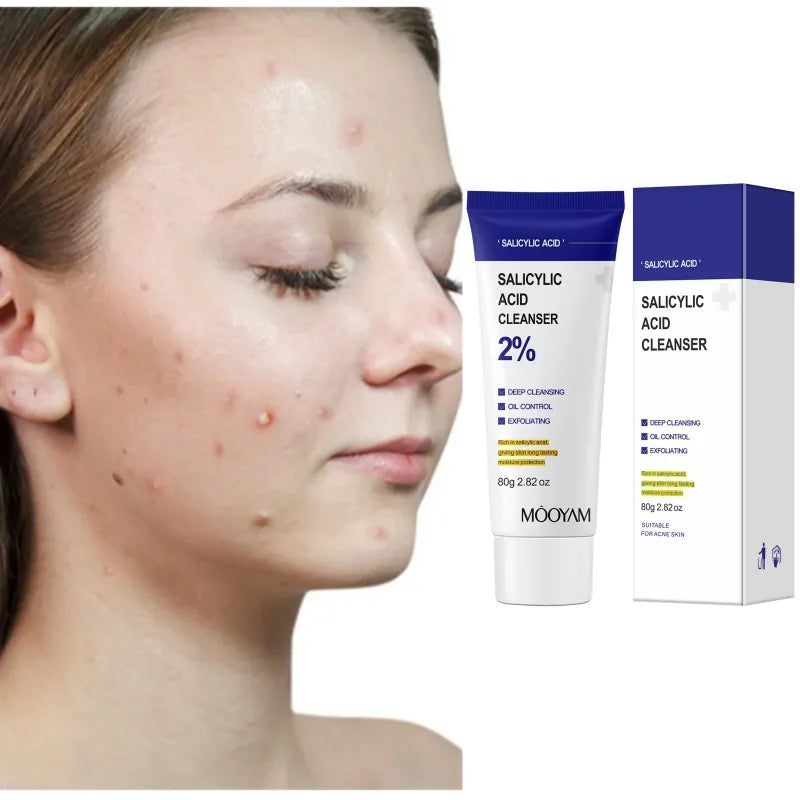 MOOYAM 2% Salicylic Acid Acne Removal Face Cleanser (80g) - Facial Exfoliant for Blackheads, Enlarged Pores, Wrinkles & Fine Lines