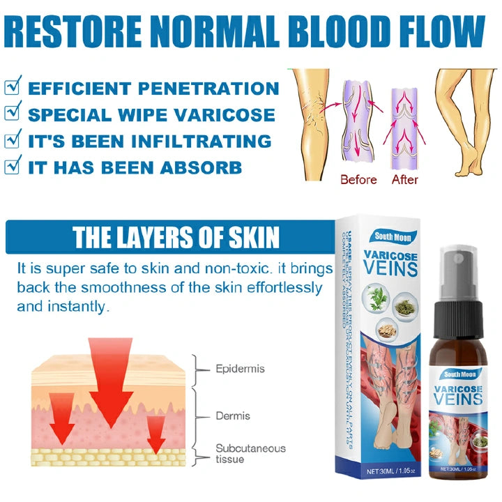 Varicose Veins Herbal Treatment Spray - Improves Blood Circulation  (BUY 1 GET 1 FREE)