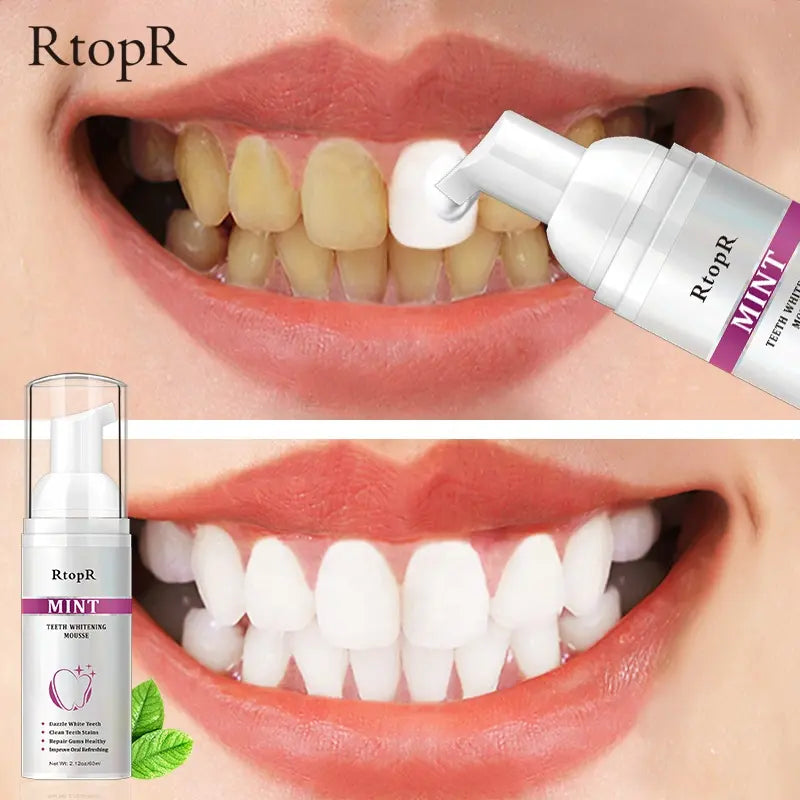 RtopR Mint Teeth Whitening Mousse - Deeply Cleaning Teeth Whitening Foam Toothpaste For Stain Removal & Improve Oral Refreshing – 60ml