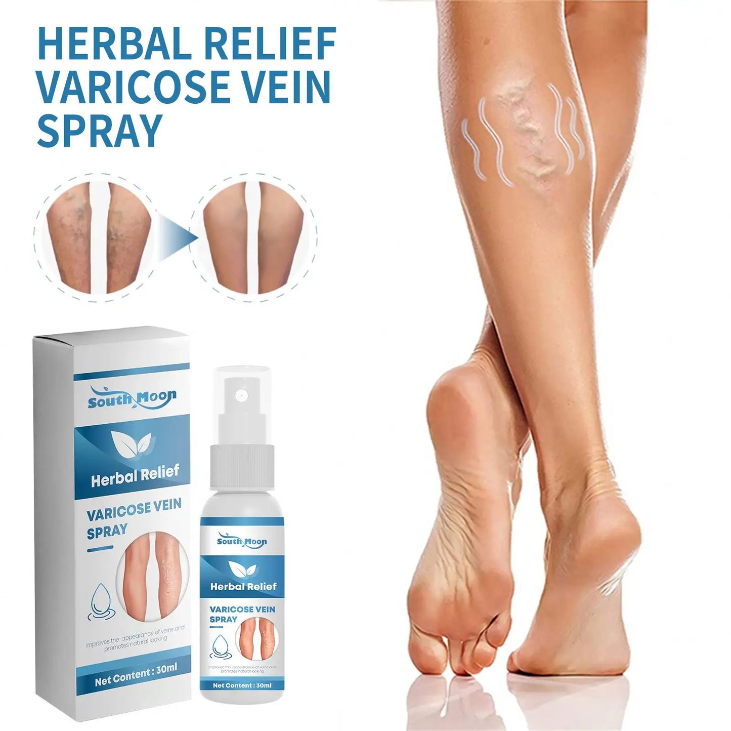 Varicose Veins Herbal Treatment Spray - Improves Blood Circulation  (BUY 1 GET 1 FREE)