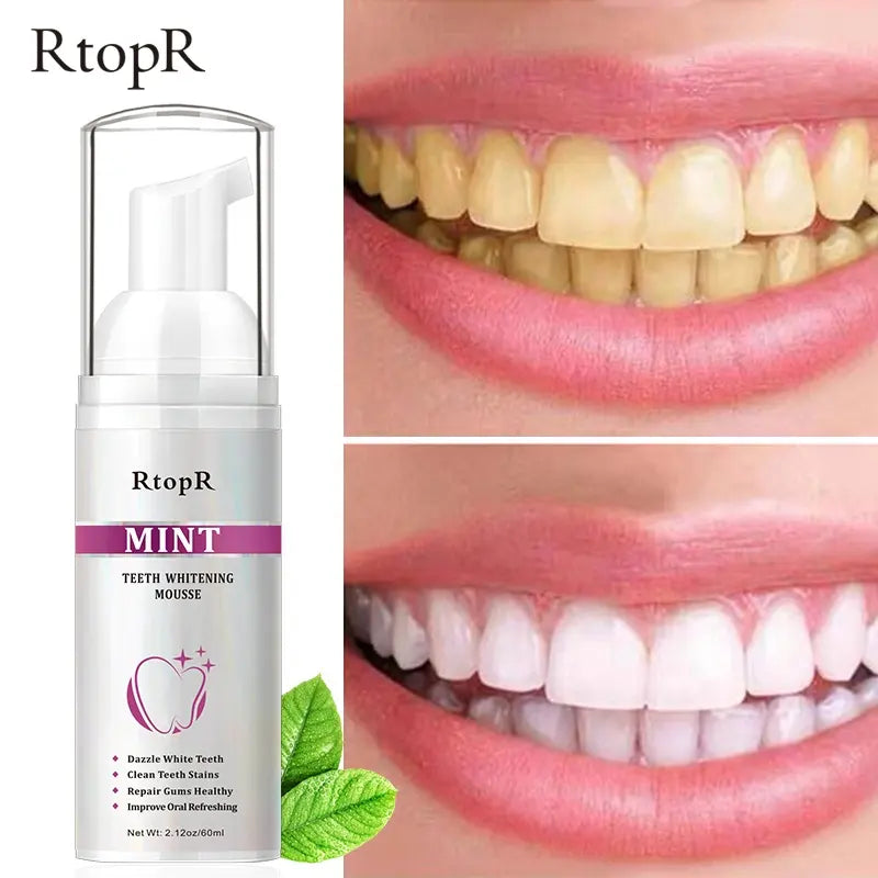 RtopR Mint Teeth Whitening Mousse - Deeply Cleaning Teeth Whitening Foam Toothpaste For Stain Removal & Improve Oral Refreshing – 60ml