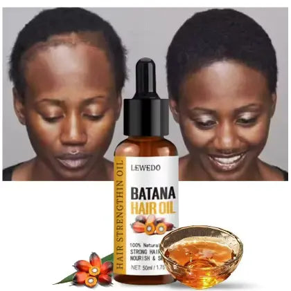 Natural Batana Hair Growth Oil – Nourish, Regrow & Anti Hair Loss Oil – 50 ml