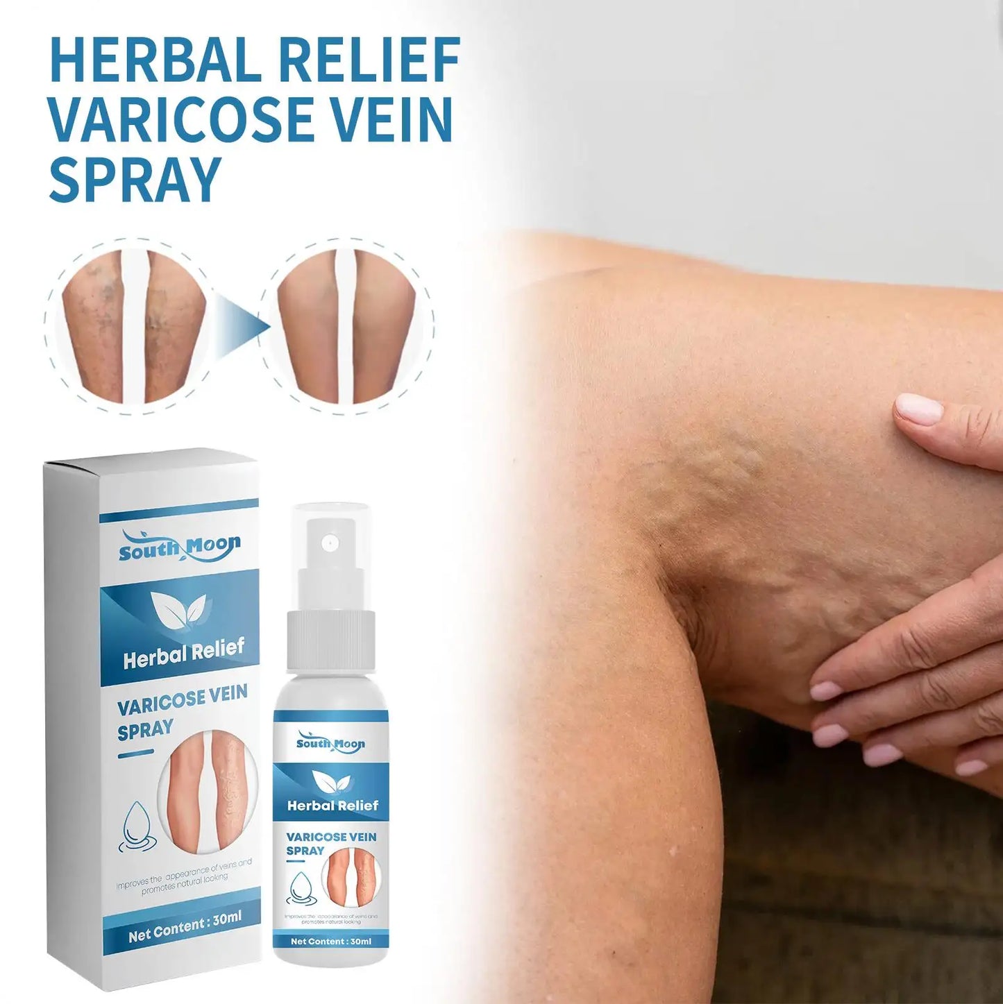 Varicose Veins Herbal Treatment Spray - Improves Blood Circulation  (BUY 1 GET 1 FREE)