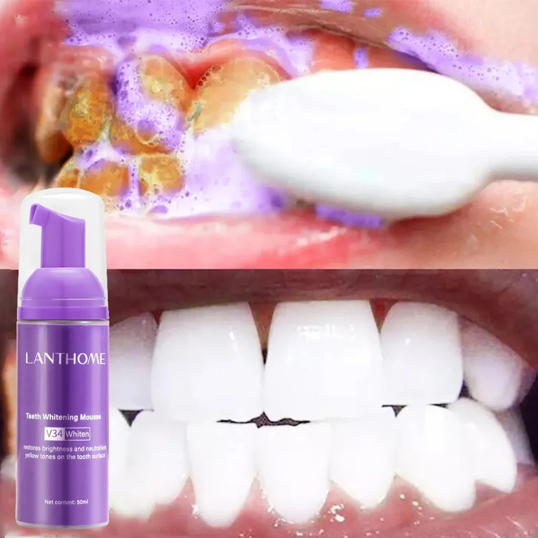 Teeth Whitening Mousse - Deep Cleaning & Whitening Foam Mousse - 50 mls