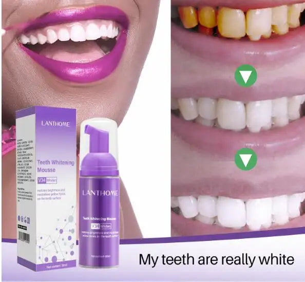 Teeth Whitening Mousse - Deep Cleaning & Whitening Foam Mousse - 50 mls