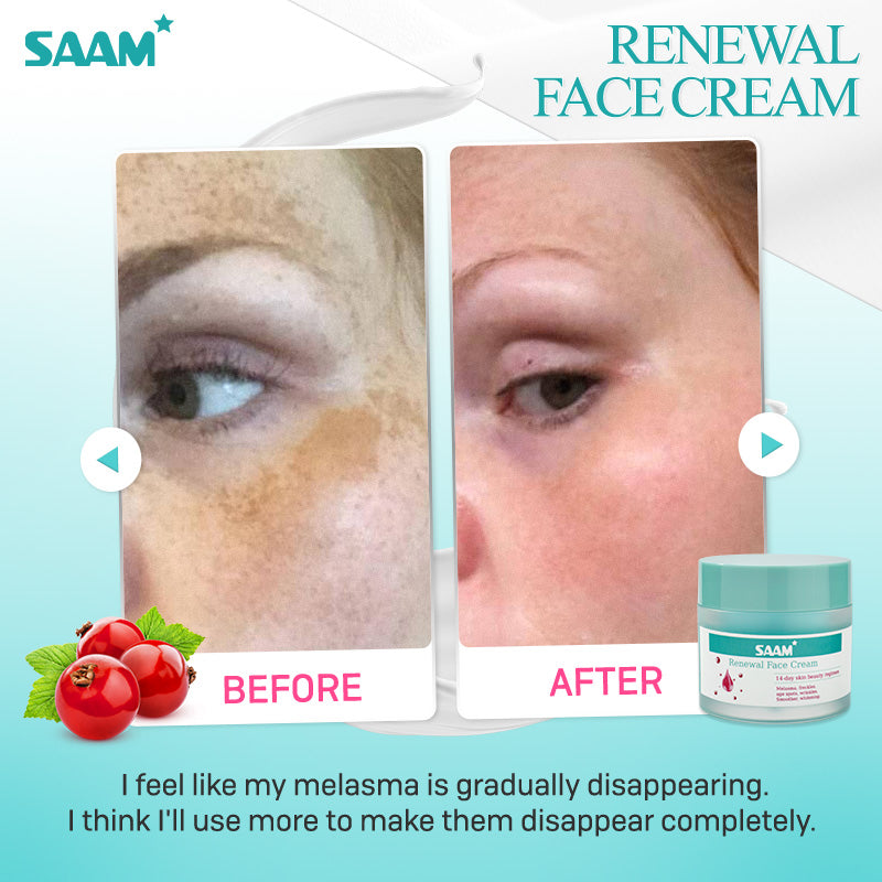 SAAM Renewal Face Cream - Specialized Treatment Cream for Melasma, Freckles, Age Spots & Dark Spots.